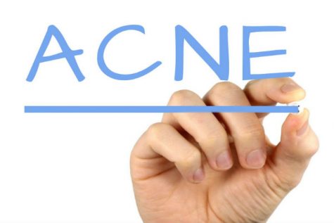 Acne Sufferers May Be Protected Against Aging